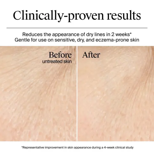 Neutrogena Hydro Boost Hyaluronic Acid Gel Cream For Normal to Dry Skin 14 mL (0.5 oz)'s photo #5