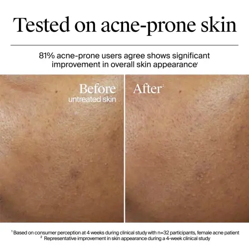 Neutrogena Hydro Boost Hyaluronic Acid Gel Cream For Normal to Dry Skin 14 mL (0.5 oz)'s photo #6