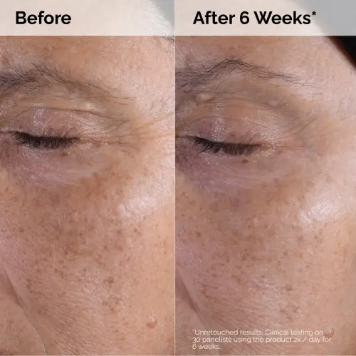 The Ordinary Glycolic Acid 7% Exfoliating Toner 240 mL (8 oz)'s photo #5
