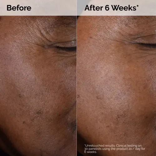 The Ordinary Glycolic Acid 7% Exfoliating Toner 240 mL (8 oz)'s photo #4