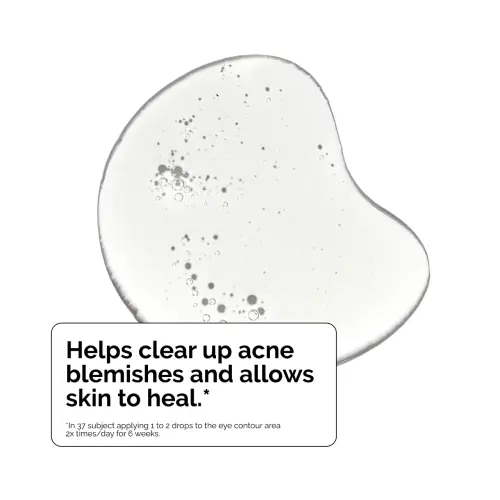 The Ordinary Salicylic Acid 2% Solution 30 mL (1 oz)'s photo #1