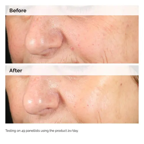 The Ordinary Alpha Arbutin 2% + HA 30 mL (1 oz) — imagen 5
