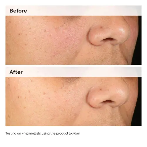 The Ordinary Alpha Arbutin 2% + HA 30 mL (1 oz) — imagen 4