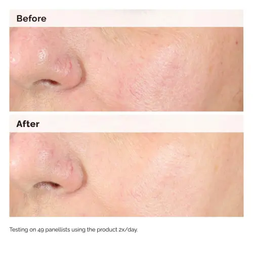 The Ordinary Alpha Arbutin 2% + HA 30 mL (1 oz) — imagen 3