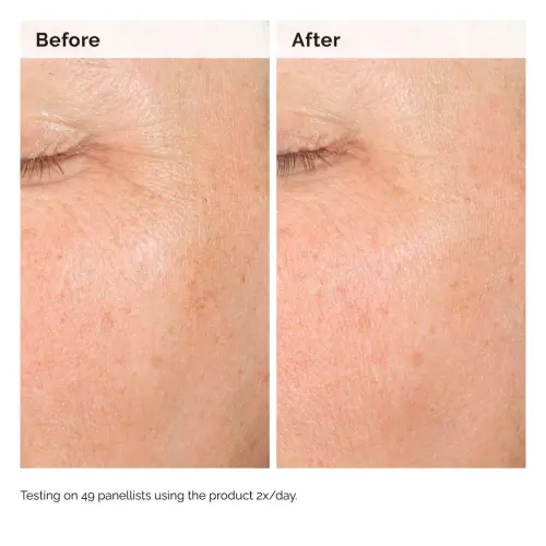 The Ordinary Alpha Arbutin 2% + HA 30 mL (1 oz) — imagen 2