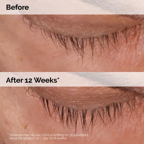 The Ordinary Multi-Peptide Lash and Brow Serum 5 mL (0.16 oz)'s photo #5