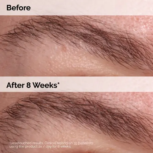 The Ordinary Multi-Peptide Lash and Brow Serum 5 mL (0.16 oz)'s photo #6