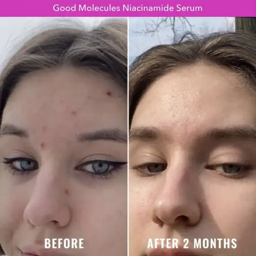 Good Molecules Niacinamide Serum 30 mL (1 oz)'s photo #2