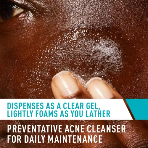 CeraVe Acne Control Cleanser 2% Salicylic Acid Acne Treatment 473 mL (16 oz)'s photo #3