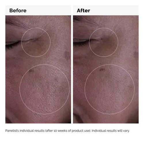 The Ordinary Growth Factors 15% Solution 30 mL (1 oz) — imagen 7