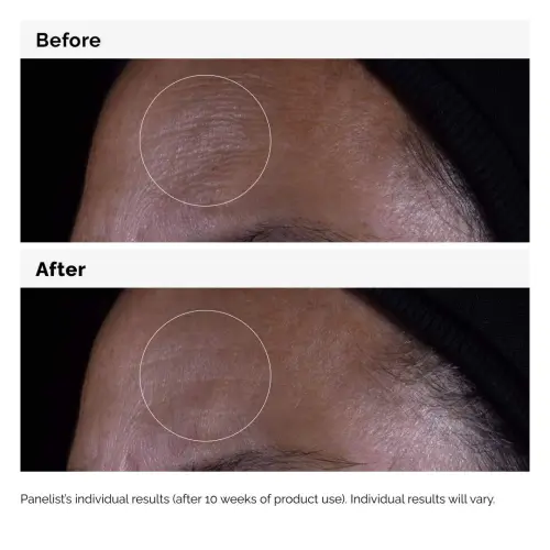 The Ordinary Growth Factors 15% Solution 30 mL (1 oz) — imagen 6