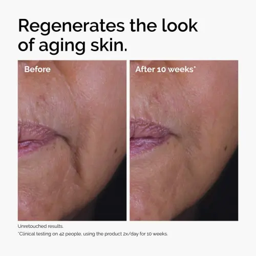 The Ordinary Growth Factors 15% Solution 30 mL (1 oz) — imagen 5