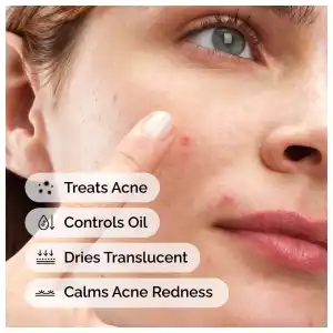 The Ordinary Sulfur 10% Powder-to-Cream Concentrate 5 g (0.18 oz) miniatura 6