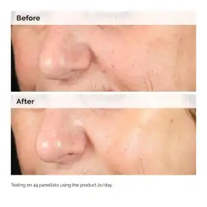 The Ordinary Alpha Arbutin 2% + HA 30 mL (1 oz) miniatura 5