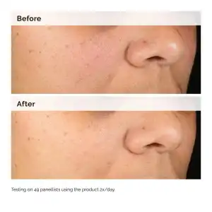 The Ordinary Alpha Arbutin 2% + HA 30 mL (1 oz) miniatura 4