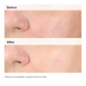 The Ordinary Alpha Arbutin 2% + HA 30 mL (1 oz) miniatura 3