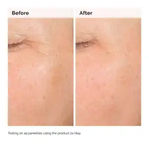 The Ordinary Alpha Arbutin 2% + HA 30 mL (1 oz) miniatura 2