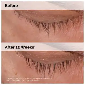 The Ordinary Multi-Peptide Lash and Brow Serum 5 mL (0.16 oz) miniatura 6