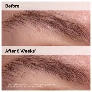 The Ordinary Multi-Peptide Lash and Brow Serum 5 mL (0.16 oz) miniatura 7