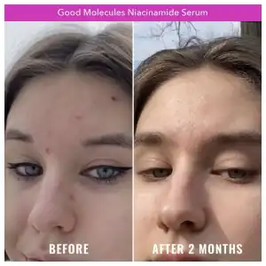 Good Molecules Niacinamide Serum 30 mL (1 oz) miniatura 3
