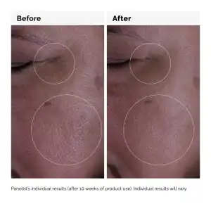 The Ordinary Growth Factors 15% Solution 30 mL (1 oz) miniatura 7