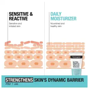 Neutrogena Ultra Gentle Daily Facial Moisturizer 100 mL (3.4 oz) miniatura 6
