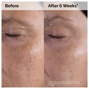 The Ordinary Glycolic Acid 7% Exfoliating Toner 100 mL (3.4 oz) miniatura 6