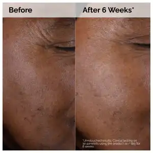 The Ordinary Glycolic Acid 7% Exfoliating Toner 100 mL (3.4 oz) miniatura 5